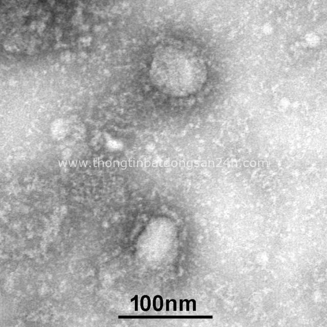 Đột phá vĩ đại của Úc: Tái tạo thành công virus corona để thế giới tăng tốc tìm ra loại vắc xin chữa bệnh - Ảnh 2.