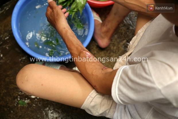 Xóm chạy thận ở Hà Nội chật vật dưới cái nóng trên 50 độ: “Khát không được uống nhiều nước, nằm xuống giường nóng như nằm dưới nền đường - Ảnh 13.